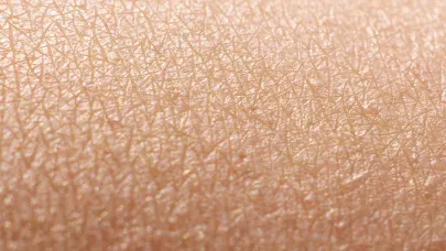 Photo of skin with a healthy skin barrier