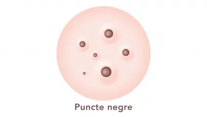 Puncte negre